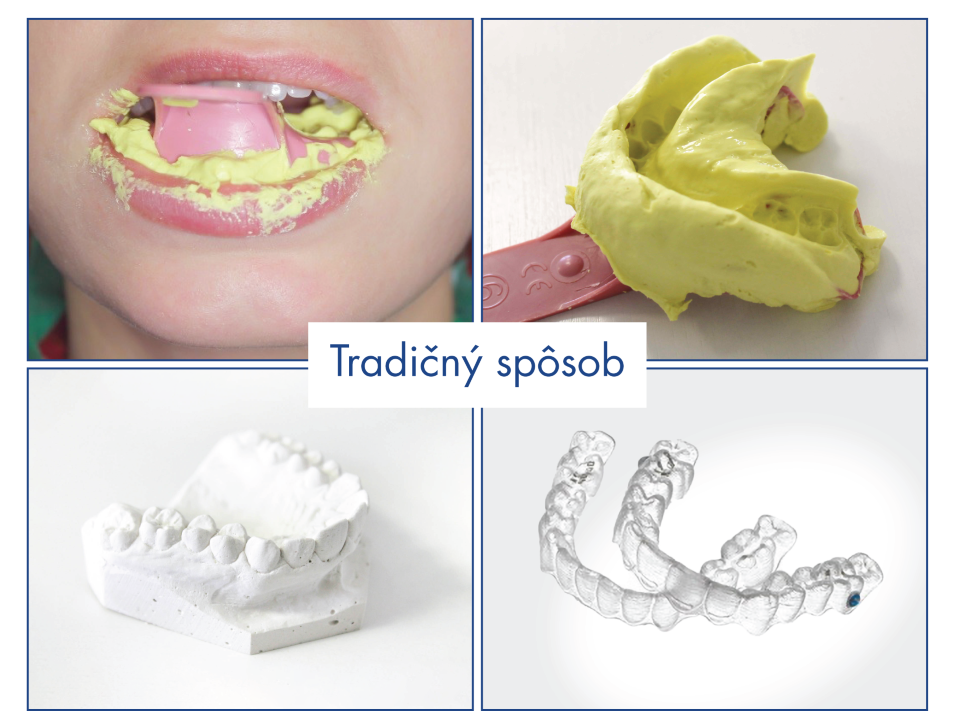 Máme unikátnu 3D tlačiareň. Prečo je to skvelá správa pre pacientov?