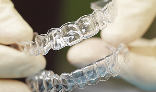 7 KROKOV K ROVNÝM ZUBOM S NEVIDITEĽNÝM APARÁTOM INVISALIGN  
