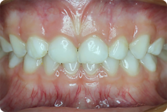 obrázok ideálne detské zuby