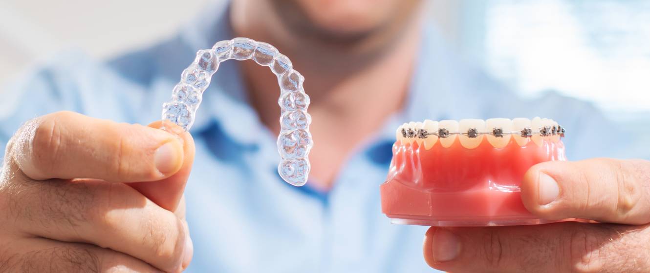 Ortodontická liečba