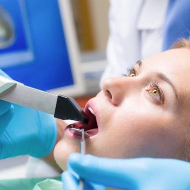 U nás už žiadne nepríjemné odtlačky, máme SCANNER iTERO od Invisalign!